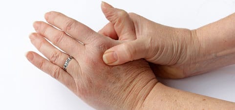 4 natural pain relief remedies for arthritis