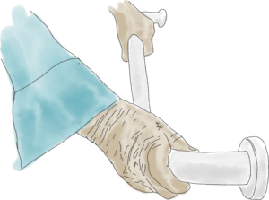 Falling up household injury